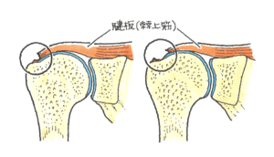 ポイント8図2.gif