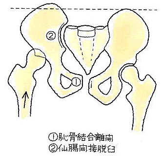 恥骨結合離開.png