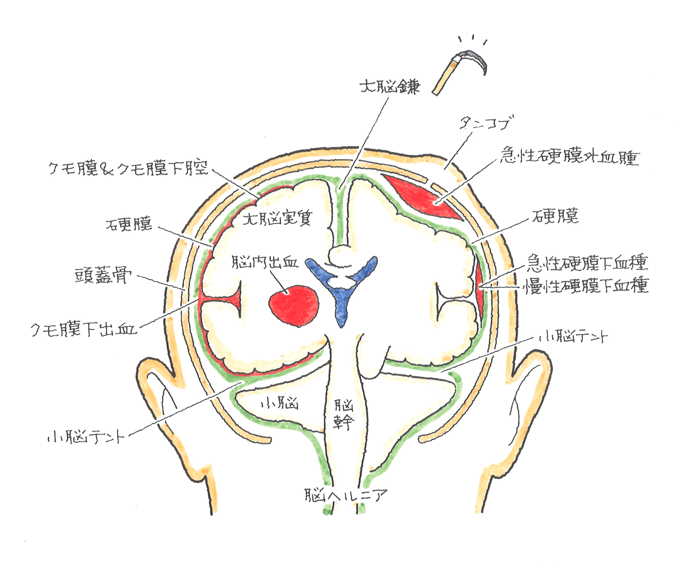 ポイント32図１.png