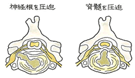 ポイント２図２.gif