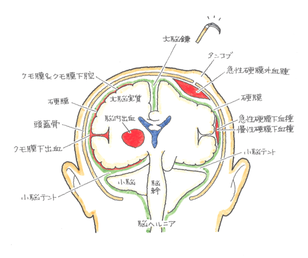 ポイント２４－１.gifのサムネール画像のサムネール画像のサムネール画像