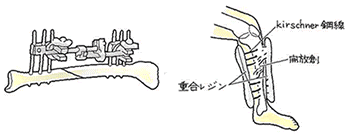 ポインﾄ１１８③.gif