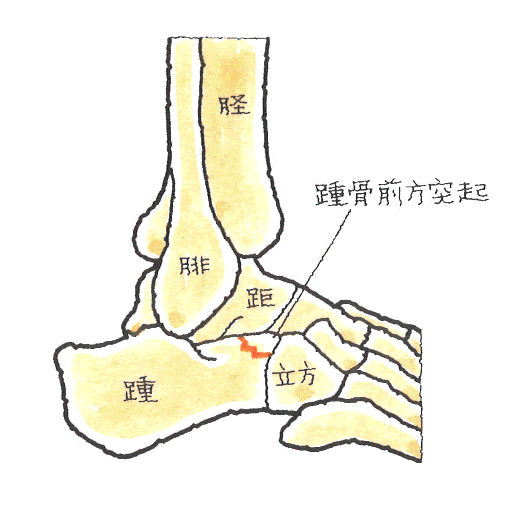 前方突起の図.gif